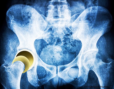 Diamond s Exceptional Role in Modern Medicine: From Surgical Instruments to Nanomedicine