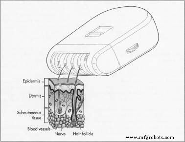 Comprehensive Guide to Modern Epilation Devices: Design, History, and Future