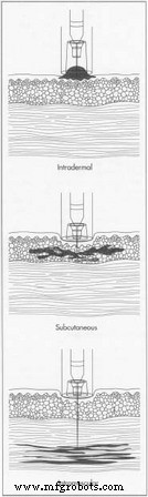 Innovative Needle‑Free Injection Systems: Advancing Safe and Pain‑Free Medication Delivery