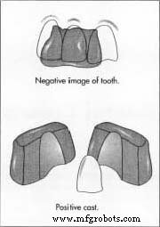 Dental Crowns: Materials, Design, and Modern Fabrication Techniques