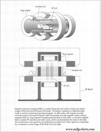 Magnetic Resonance Imaging (MRI): Principles, Evolution, and Clinical Applications