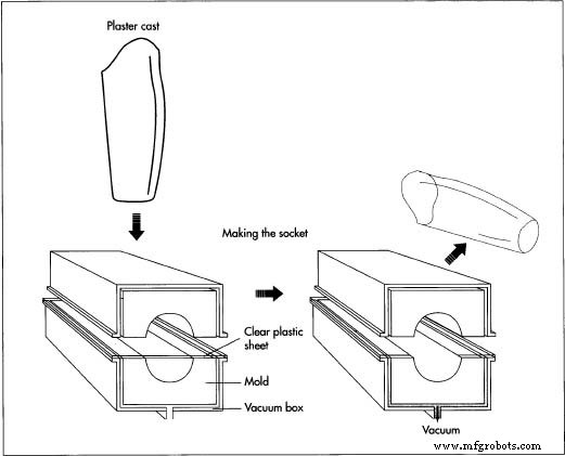 The Evolution and Modern Science of Prosthetic Limbs