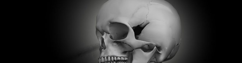 Will 3D‑Printed Bone Implants Become Standard Care?