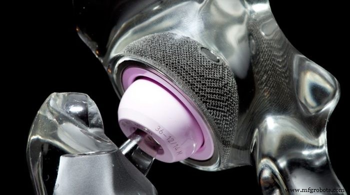 Revolutionizing Bone Implants: How 3D Printing Enhances Fit, Longevity, and Performance