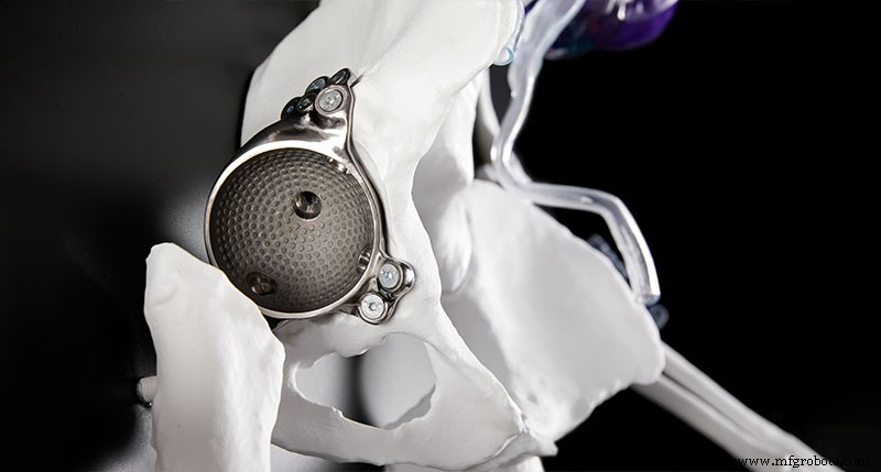 Lean Principles in Healthcare: Personalization Drives Better Outcomes