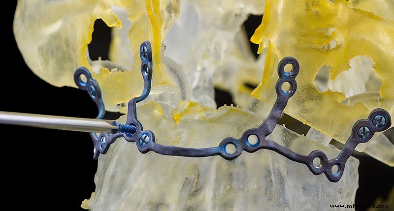 Lean Principles in Healthcare: Personalization Drives Better Outcomes