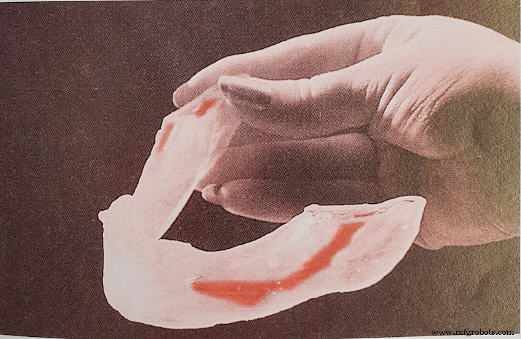 30 Years of Materialise: Advancing Medical 3D Printing for Safer, Predictable Patient Outcomes