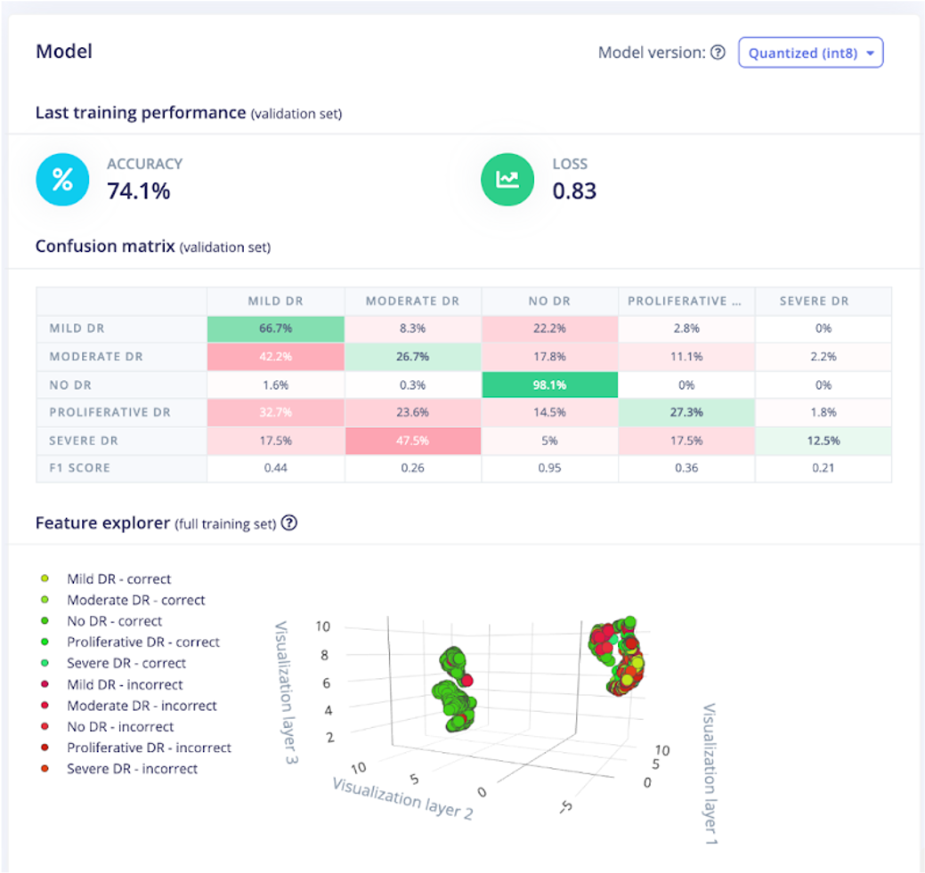 Build an Offline AI Model that Detects Diabetic Retinopathy Stages with Edge‑Impulse
