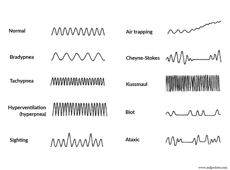 mmWave Radar for Contactless Monitoring of Heart and Breath Rates