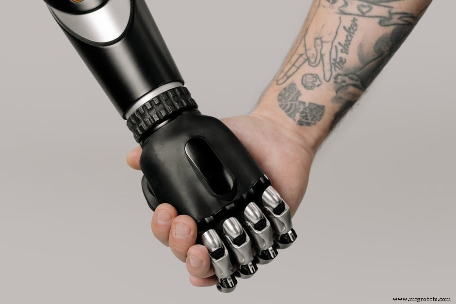 Carbon Fiber Prosthetics: How High‑Performance Materials Transform Limb Replacement