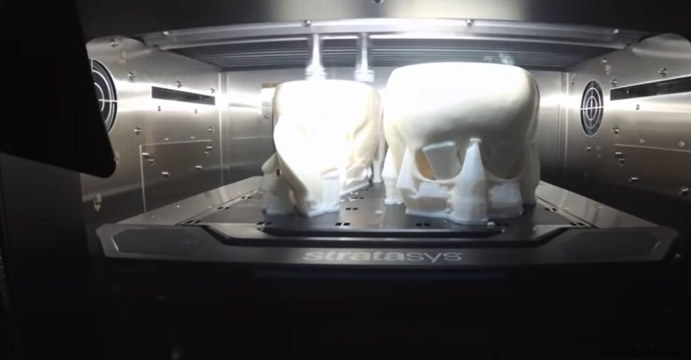 3D‑Printed Surgical Models Enable Historic Separation of Rare Head‑Fused Twins
