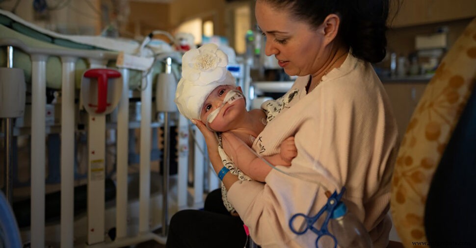 3D‑Printed Surgical Models Enable Historic Separation of Rare Head‑Fused Twins