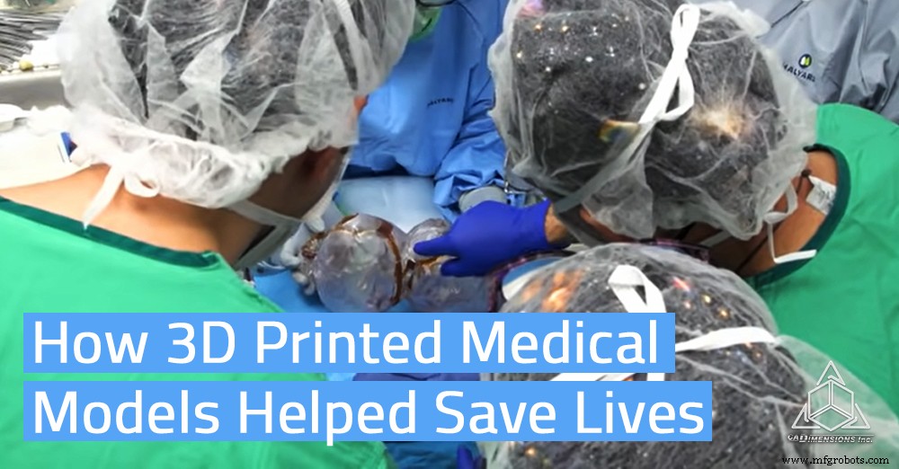 3D‑Printed Surgical Models Enable Historic Separation of Rare Head‑Fused Twins