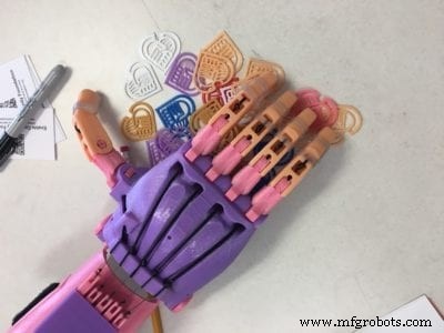 3D‑Printed Prosthetics: Transforming Access and Affordability for Amputees