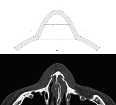 Face First: Protecting Your Nose with Markforged Kevlar® Reinforced Masks