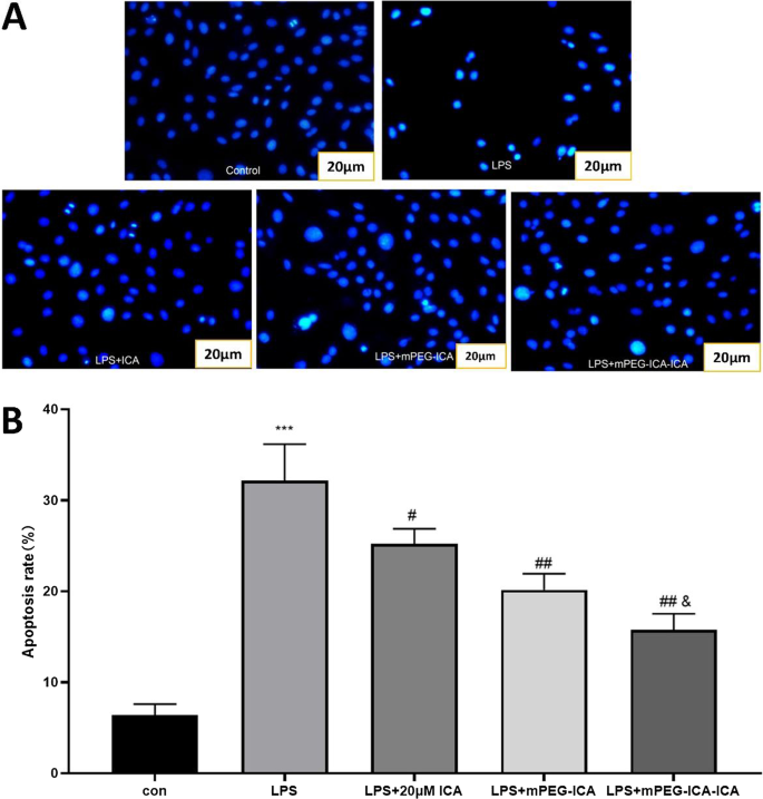Icariin‑Loaded mPEG Nanoparticles: Enhanced Protection Against LPS‑Induced Cardiotoxicity in H9c2 Cells
