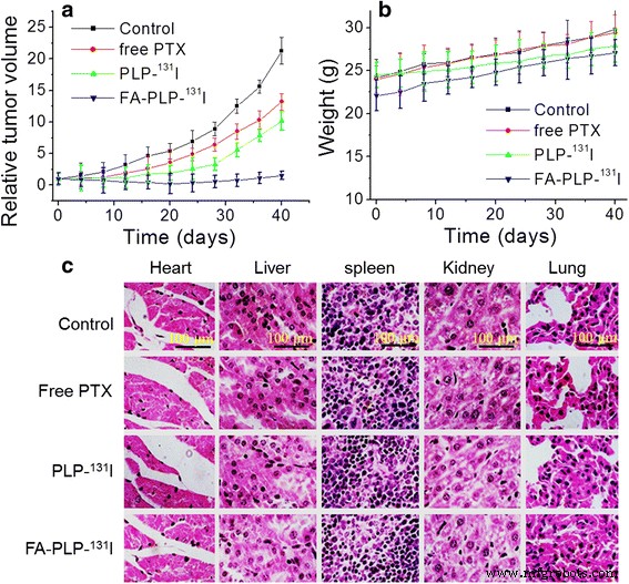 131I‑Labeled PLGA‑Lipid Nanoparticles for Targeted Paclitaxel Delivery and Imaging in Melanoma Therapy