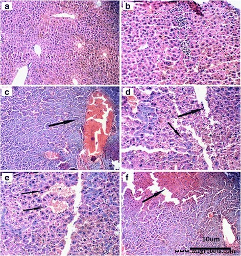 Dose‑Dependent Liver, Brain, and Embryonic Toxicity of Titanium Dioxide Nanoparticles in Mice