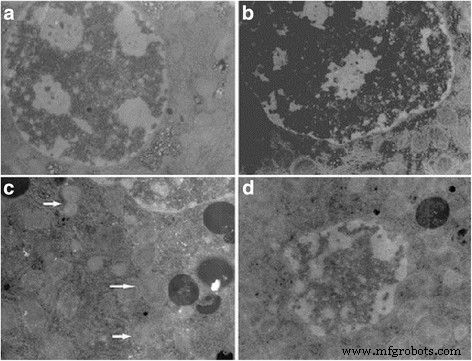 Dose‑Dependent Liver, Brain, and Embryonic Toxicity of Titanium Dioxide Nanoparticles in Mice