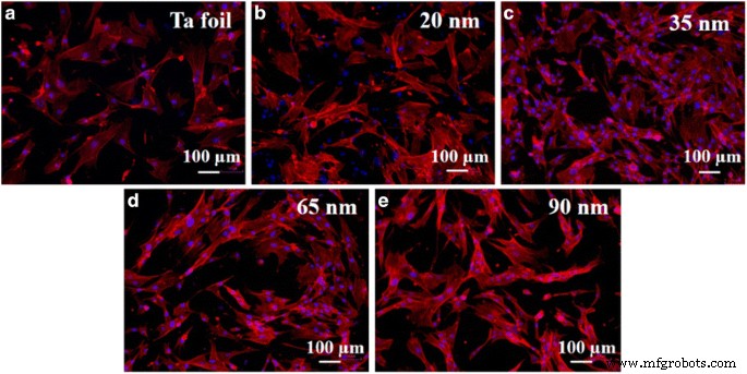 Optimized Biocompatibility of Anodic Tantalum Oxide Nanotube Arrays
