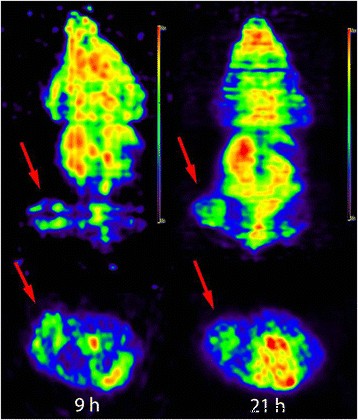 64Cu‑Labeled AGuIX Nanoprobes: PET‑Guided Radiotherapy and Radiosensitization in HepG2 Tumor‑Bearing Mice