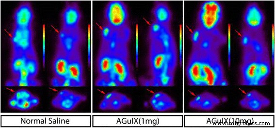 64Cu‑Labeled AGuIX Nanoprobes: PET‑Guided Radiotherapy and Radiosensitization in HepG2 Tumor‑Bearing Mice