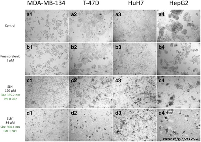 Innovative Nucleoside–Lipid Nanocarriers Enhance Sorafenib Delivery and Reduce Toxicity