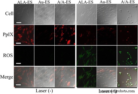 Biocompatible 5‑Aminolevulinic Acid / Gold Nanoparticle‑Loaded Ethosomal Vesicles: A Synergistic Photodynamic/Photothermal Transdermal Strategy for Hypertrophic Scar Treatment