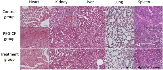 PEG-CoFe₂O₄ Nanoparticles: Assessing Toxicity and Curcumin’s Protective Effect