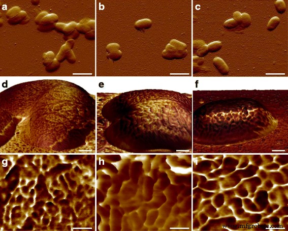 Unveiling E. coli Genotype-Specific Macromolecules Using AFM Nanomechanical Mapping