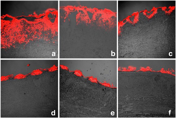 CO₂ Fractional Laser Enhances Penetration of 5‑Fluorouracil‑Loaded Ethosomes for Hypertrophic Scar Therapy