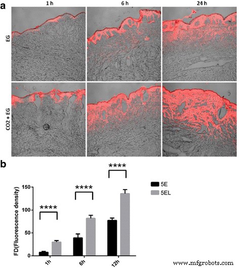 CO₂ Fractional Laser Enhances Penetration of 5‑Fluorouracil‑Loaded Ethosomes for Hypertrophic Scar Therapy