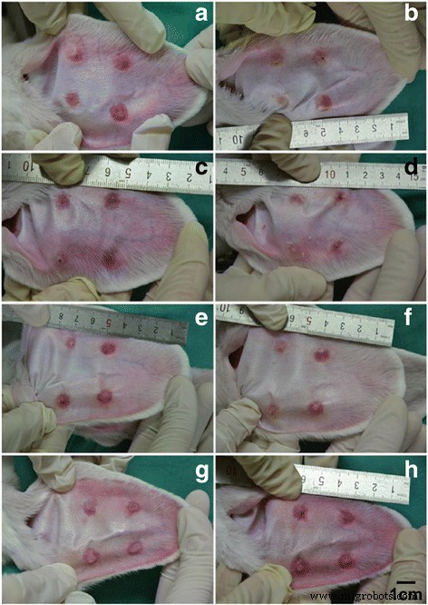 CO₂ Fractional Laser Enhances Penetration of 5‑Fluorouracil‑Loaded Ethosomes for Hypertrophic Scar Therapy
