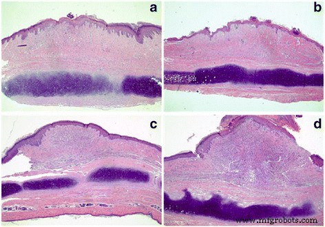 CO₂ Fractional Laser Enhances Penetration of 5‑Fluorouracil‑Loaded Ethosomes for Hypertrophic Scar Therapy
