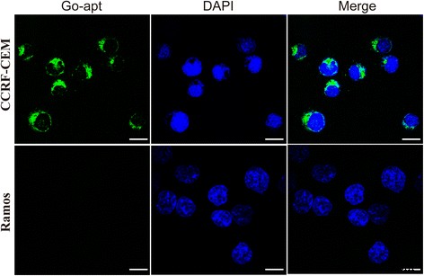 High-Sensitivity Graphene Oxide Fluorescent Aptasensor for Rapid Detection of CCRF-CEM Leukemia Cells