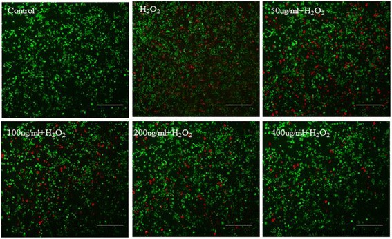 Green‑Synthesized Cerium‑Doped Carbon Nanoparticles Deliver Superior Hydroxyl‑Radical Scavenging for Antioxidant Therapy