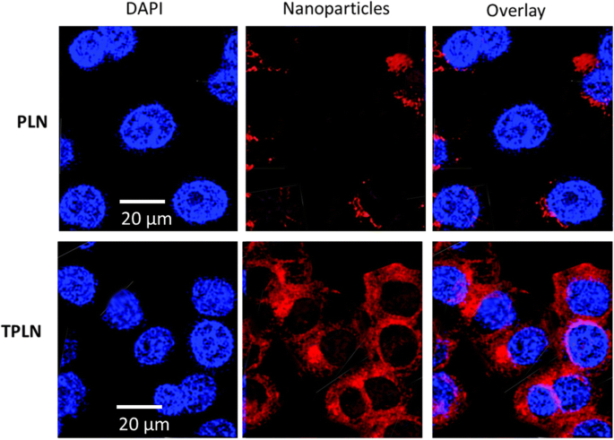 Targeted Lipid Nanoparticles Functionalized with Transferrin Enhance Paclitaxel Efficacy in Leukemia Cells