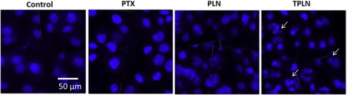 Targeted Lipid Nanoparticles Functionalized with Transferrin Enhance Paclitaxel Efficacy in Leukemia Cells