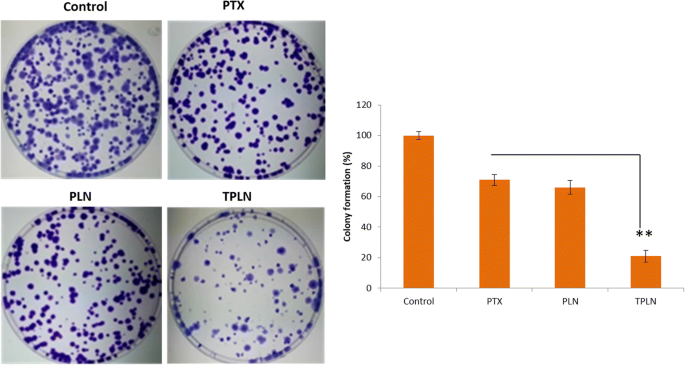 Targeted Lipid Nanoparticles Functionalized with Transferrin Enhance Paclitaxel Efficacy in Leukemia Cells