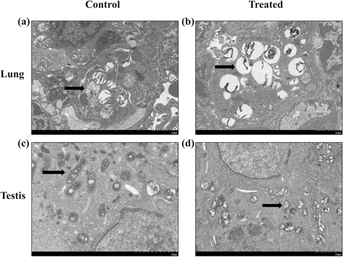 Silica Nanoparticle Impact on Gene Expression and DNA Methylation in Lung and Testis Tissues