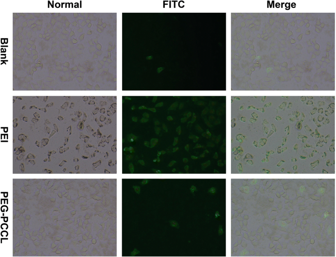 PEG‑PCCL Nanoparticles: Low‑Toxicity, Sustained Paclitaxel Delivery and Enhanced Anti‑Tumor Efficacy in Hepatocarcinoma Models