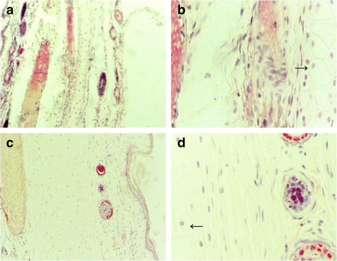 PEG‑PCCL Nanoparticles: Low‑Toxicity, Sustained Paclitaxel Delivery and Enhanced Anti‑Tumor Efficacy in Hepatocarcinoma Models