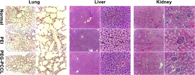 PEG‑PCCL Nanoparticles: Low‑Toxicity, Sustained Paclitaxel Delivery and Enhanced Anti‑Tumor Efficacy in Hepatocarcinoma Models