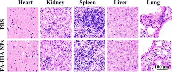 High‑Efficiency Tumor‑Targeted Photo‑Chemo Theranostic Nanoparticles: Artesunate‑Loaded, ICG‑Conjugated Human Serum Albumin