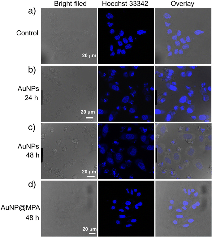 Lithocholic Acid–Functionalized Gold Nanoparticles Induce Selective Apoptosis in Liver Cancer Cells