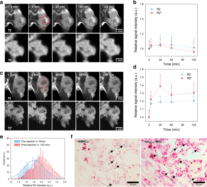 HER2-Targeted Magnetic Nanosensitizer Enhances In Vivo MRI for HER2-Positive Cancers