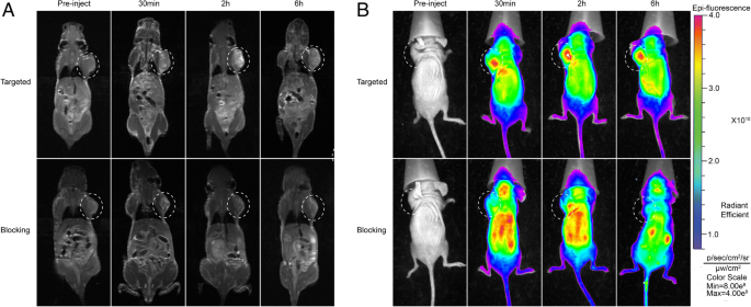 Dual‑Mode MRI/Fluorescence Nanoprobe cRGD‑Gd‑Cy5.5 for Targeted Imaging of Integrin αvβ3‑Positive Tumors