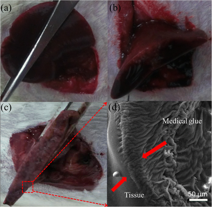 Rapid Liver Hemostasis via Electric‑Field‑Enhanced Electrospun Medical Glue Fibers