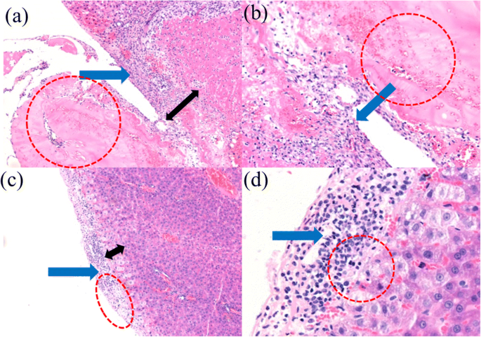 Rapid Liver Hemostasis via Electric‑Field‑Enhanced Electrospun Medical Glue Fibers