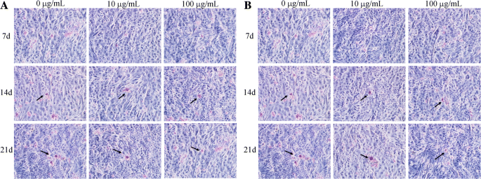 Zirconia Nanoparticles Trigger ROS‑Mediated Cytotoxicity and Suppress Osteogenic Differentiation in 3T3‑E1 Osteoblasts